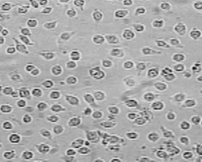 Na 24-godzinne hodowle linii komórkowych A549 i L929 nanoszono różne stężenia badanej substancji, a następnie inkubowano w temperaturze 37 C i atmosferze 5 % CO 2 przez 3 dni.