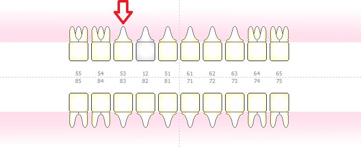 Podstawowe informacje W programie mmedica wyróżniamy dwa rodzaje diagramów stomatologicznych: Diagram dla zębów mlecznych - składający się z 20 zębów (zdj.