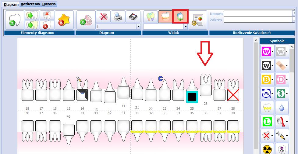 Podstawowe informacje lewy przycisk myszy na wybranym zębie, następnie przesunąć go w odpowiednie miejsce na diagramie. Zęby można przesuwać tylko w pionie (góra - dół).