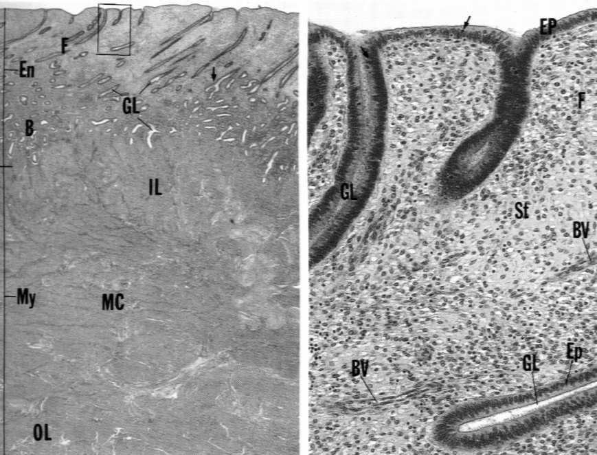 Macica Trzon i dno Endometrium nabłonek gruczoły żyła jama macicy