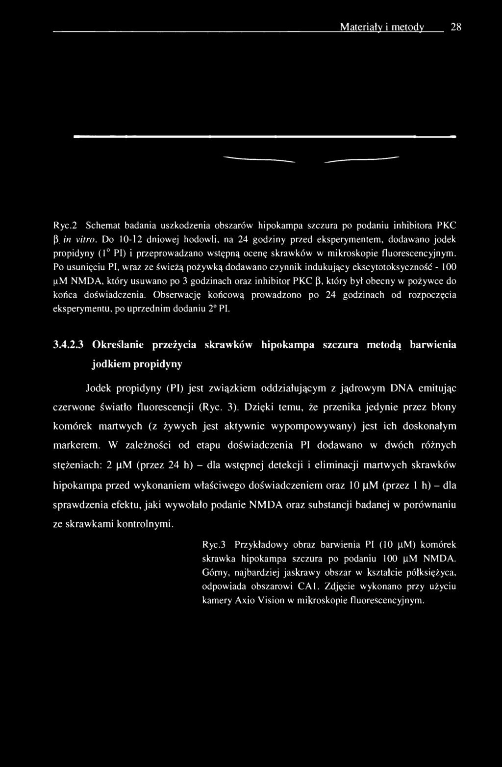 Materiały i metody 28 Ryc.2 Schemat badania uszkodzenia obszarów hipokampa szczura po podaniu inhibitora PKC (3. in vitro.