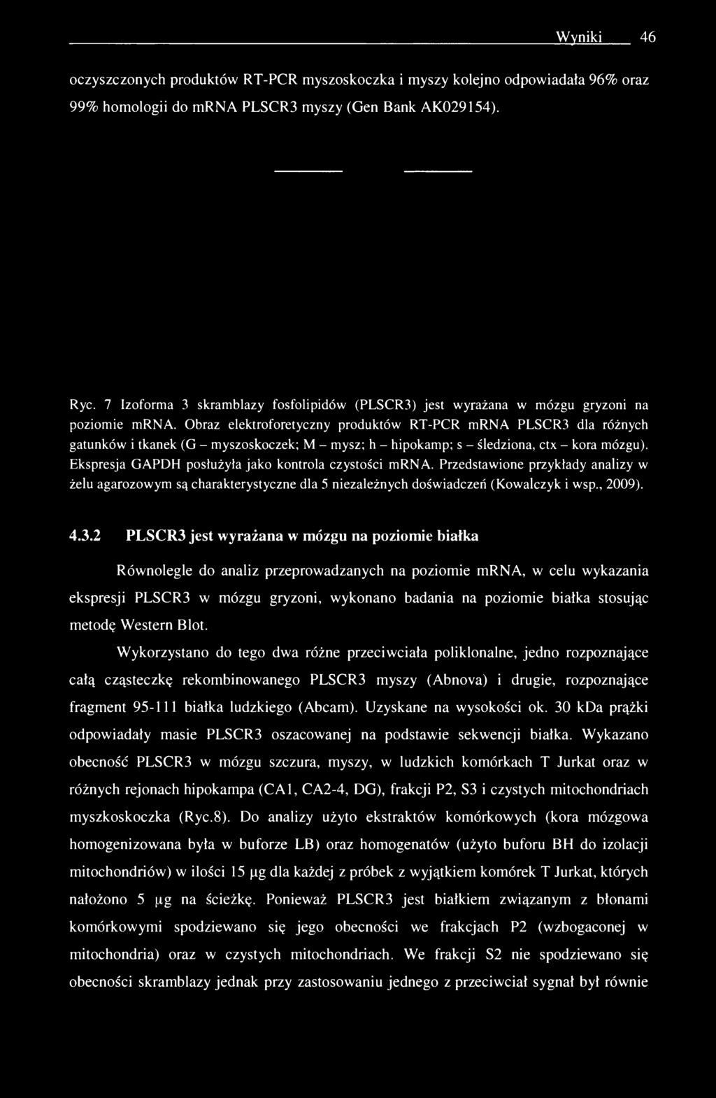 Wyniki 46 oczyszczonych produktów RT-PCR myszoskoczka i myszy kolejno odpowiadała 96% oraz 99% homologii do mrna PLSCR3 myszy (Gen Bank AK029154). Ryc.