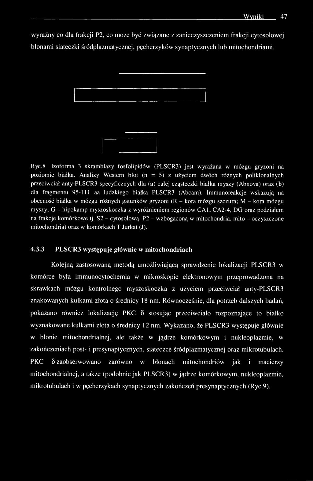 Wyniki 47 wyraźny co dla frakcji P2, co może być związane z zanieczyszczeniem frakcji cytosolowej błonami siateczki śródplazmatycznej, pęcherzyków synaptycznych lub mitochondriami. Ryc.