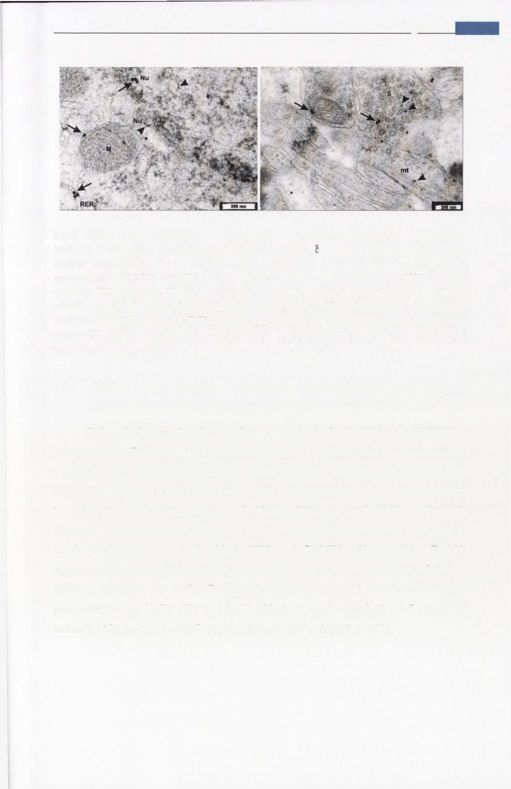 Wyniki 48 Ryc.9 Obraz immunocytochemii w mikroskopie elektronowym pokazujący występowanie izoformy 3 skramblazy fosfolipidów (PLSCR3) oraz PKCdeltaw mózgu myszoskoczka.