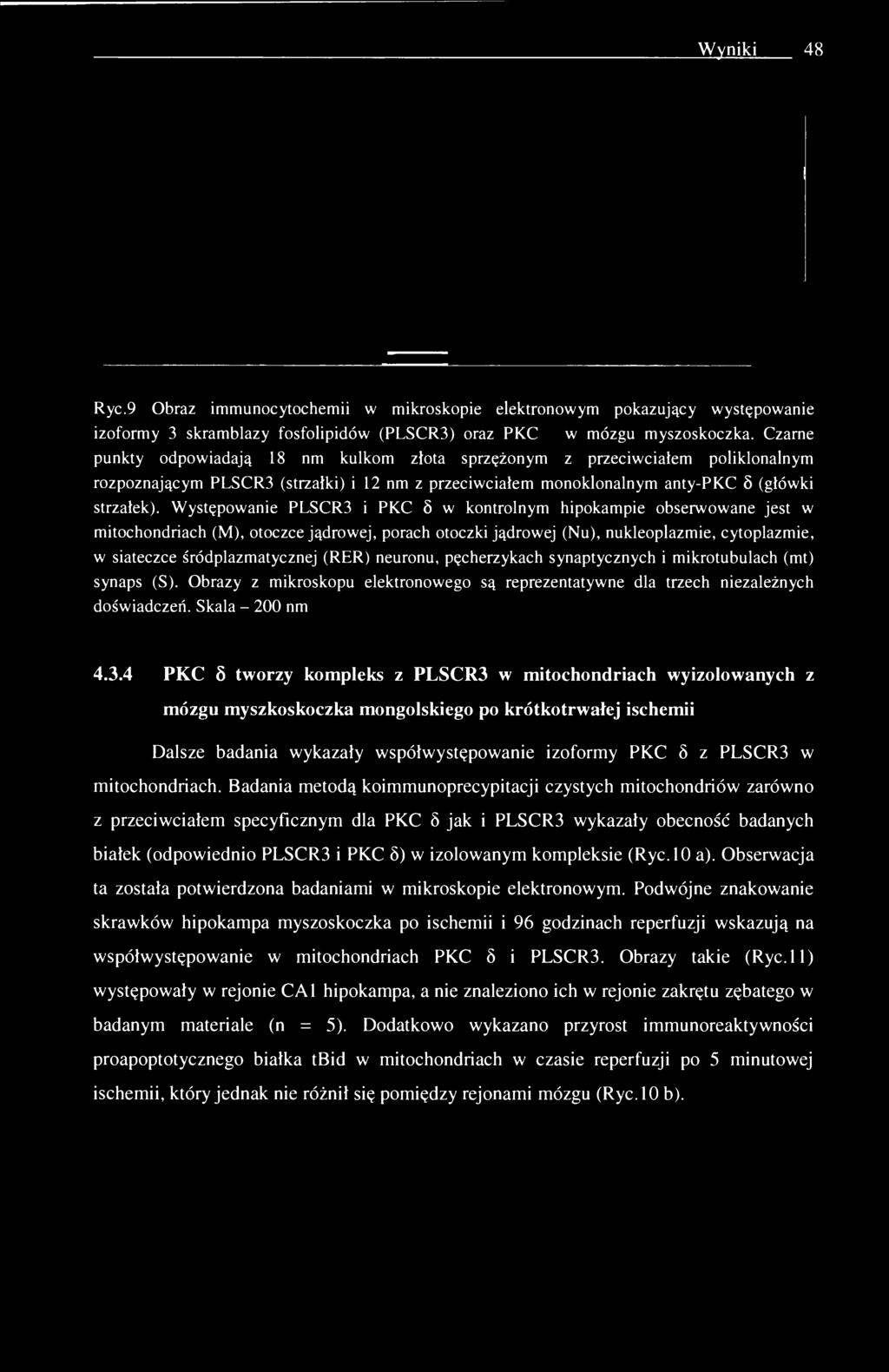 Występowanie PLSCR3 i PKC 8 w kontrolnym hipokampie obserwowane jest w mitochondriach (M), otoczce jądrowej, porach otoczki jądrowej (Nu), nukleoplazmie, cytoplazmie, w siateczce śródplazmatycznej