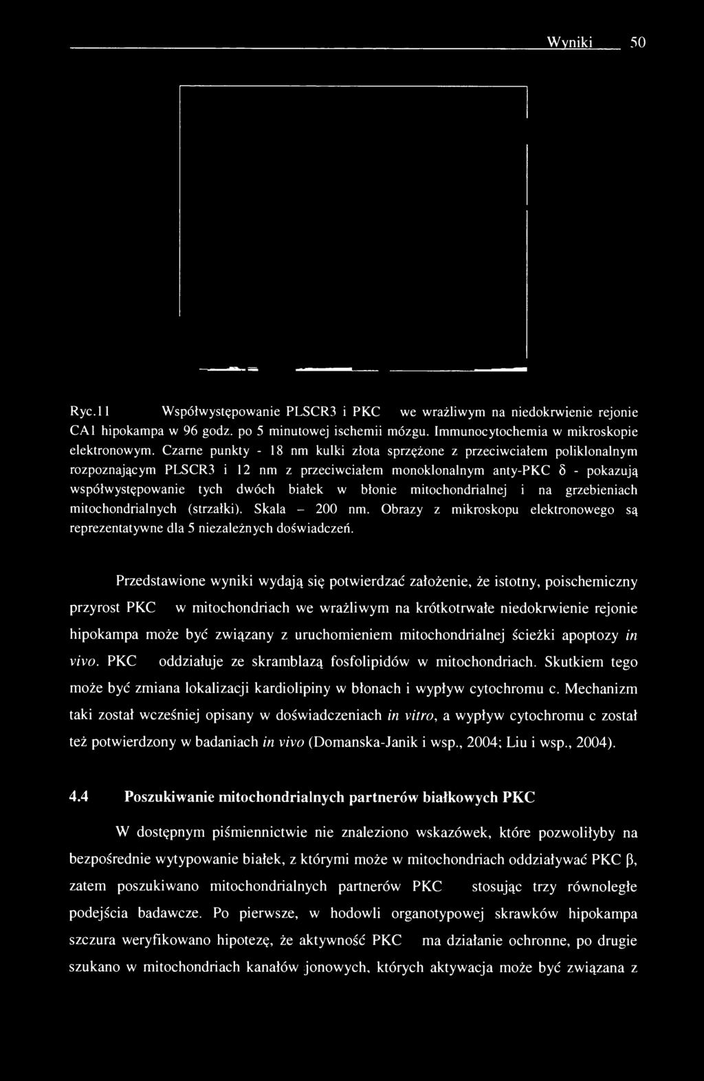 mitochondrialnej i na grzebieniach mitochondrialnych (strzałki). Skala - 200 nm. Obrazy z mikroskopu elektronowego są reprezentatywne dla 5 niezależnych doświadczeń.