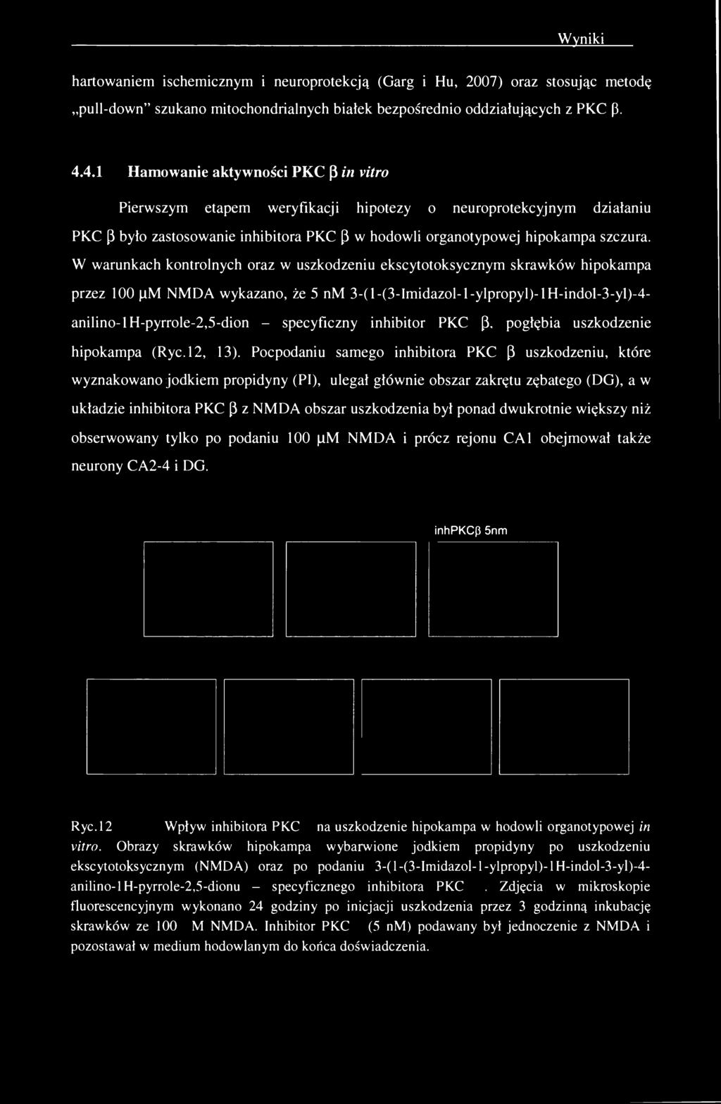 Wyniki Ę hartowaniem ischemicznym i neuroprotekcją (Garg i Hu, 2007) oraz stosując metodę pull-down" szukano mitochondrialnych białek bezpośrednio oddziałujących z PKC p. 4.