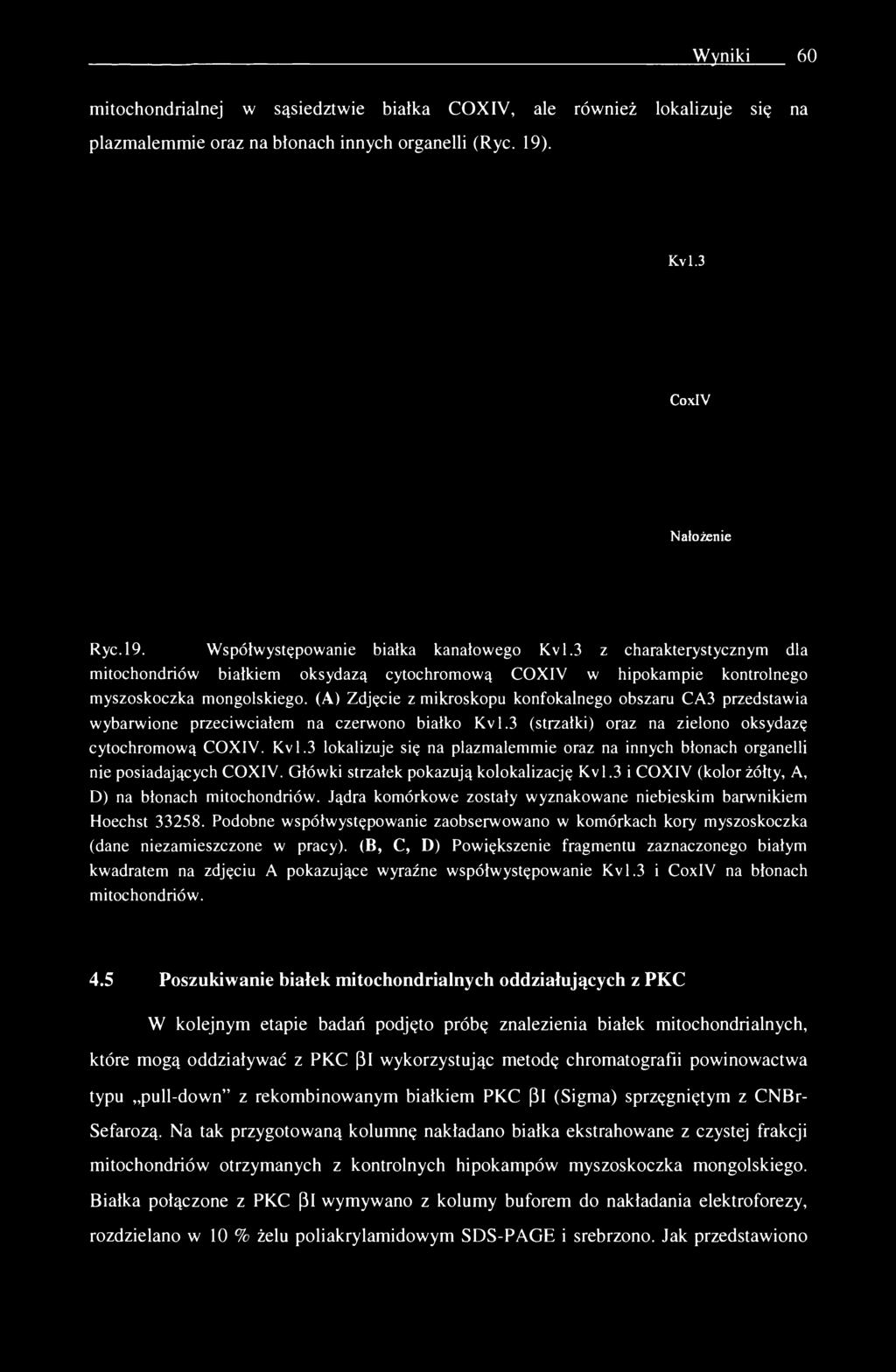 (A) Zdjęcie z mikroskopu konfokalnego obszaru CA3 przedstawia wybarwione przeciwciałem na czerwono białko Kvl.3 (strzałki) oraz na zielono oksydazę cytochromową COXIV. Kvl.3 lokalizuje się na plazmalemmie oraz na innych błonach organelli nie posiadających COXIV.