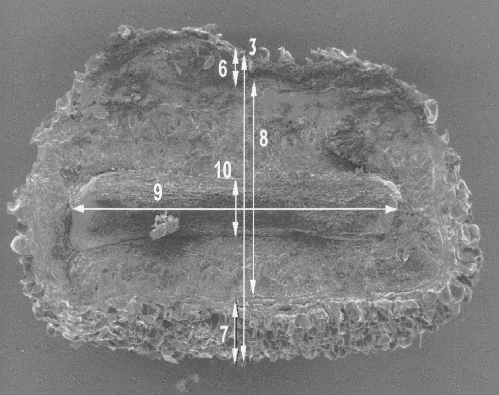 Mikromorfologiczne zróżnicowanie nasion Primula veris L.... 107 Ryc. 2 b. Uwzględnione w badaniach cechy anatomiczne nasion Primula veris L. ssp.