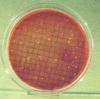 9. Place all three Petri dishes upside down in an incubator maintained at 44 C (± 0.5 C). 10.