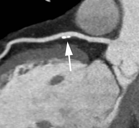 (small arrow).