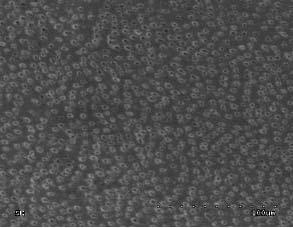 J Stoma 2013; 66, 2 Skórska-Jasak A., Klimek L., Pawlicka H. Fig. 1. Group I. Level of canal dentine clearance (canal orifice region) group I after irrigation with EDTA NaOCl, NaOCl, NaCl. Grupa I.