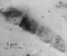 PSEUDOFOSYLIA archaiku Schopf (2006) Marshall et al.