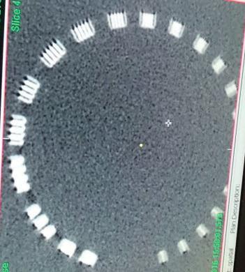 artykuł naukowy / scientific paper radioterapia / radiotherapy Fot.