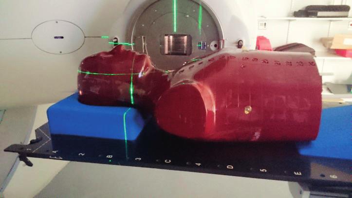 20 20 40 L L10 F0 not acceptable - picture SFOV 120 20 20 40 S S10 F0 13,5 Proces optymalizacji protokołów klinicznych oparto na ocenie ilościowej SFOV 120 20