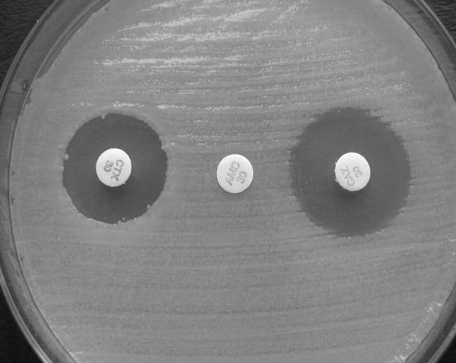 niewłaściwy dobór metod i w związku z tym niewłaściwe stosowanie testów i odczynników (np. E-testy do wykrywania MBL u pałeczek Enterobacteriaceae).