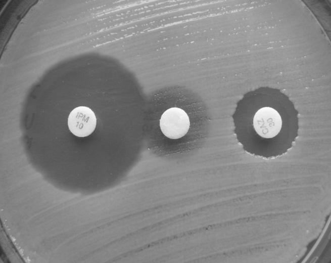 E. Młodzińska i inni K. pneumoniae PM-36 szczep z kolekcji ATCC 700603, ESBL-dodatni, służący do kontroli jakości oznaczania ESBL jako kontrola pozytywna.