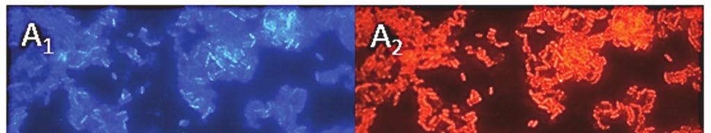 FLUORESCENCYJNA HYBRYDYZACJA IN SITU W