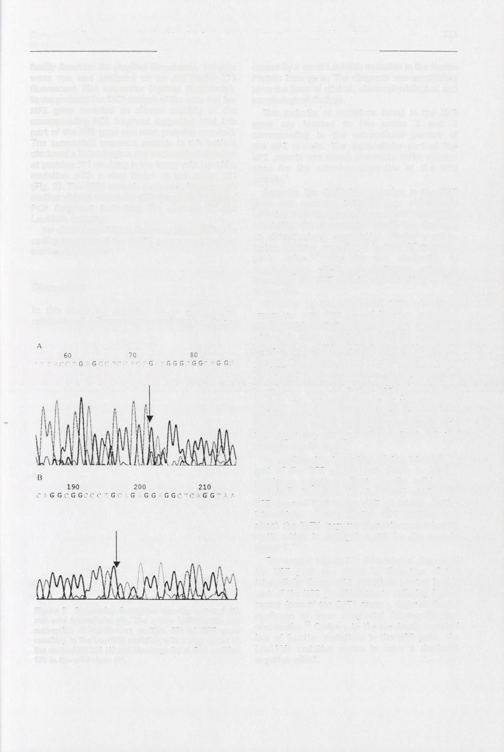 Early onset Charcot-Marie-Tooth type 1B disease caused by a novel Leu190fs mutation in the myelin protein zero gene 223 Ready Reaction Kit (Applied Biosystems).