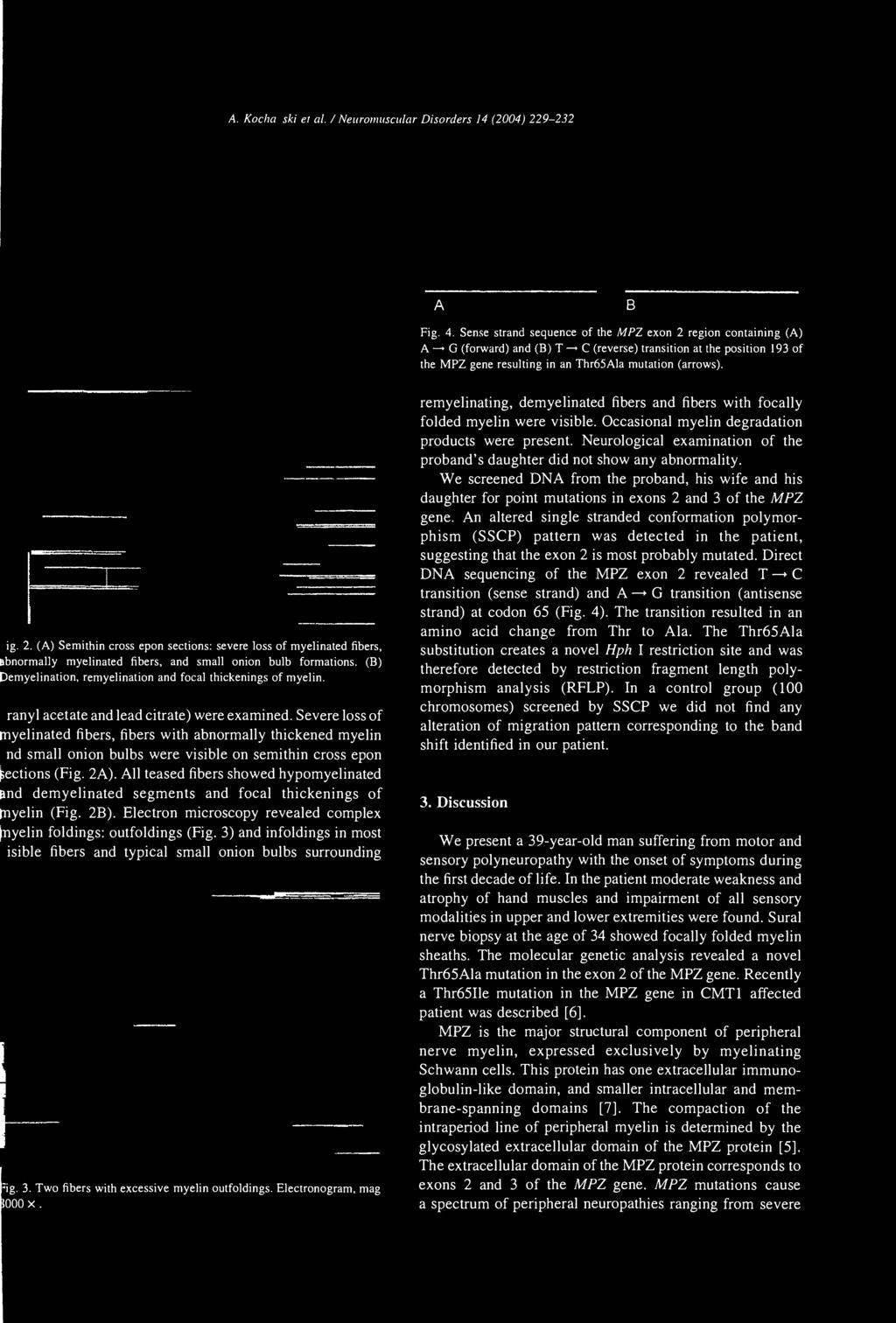 (B) emyelination, remyelination and focal thickenings of myelin. ranyl acetate and lead citrate) were examined.