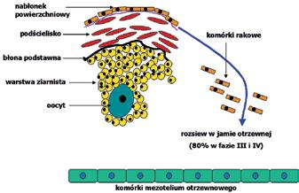 Ginekol Pol. 2015, 86, 782-786 DOI: 10.17772/gp/58751 Rycina 1.