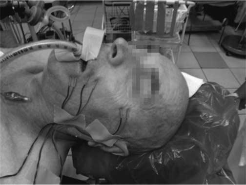 Metodologia mapowania i monitorowania śródoperacyjnego różni się w zależności od tego, jakie struktury narażone są na potencjalne uszkodzenie w czasie danego zabiegu operacyjnego.