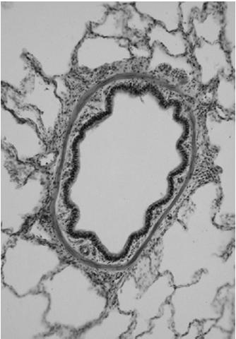 oddechowe Oskrzela główne mają taką samą budowę ściany jak