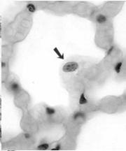 Makrofagi pęcherzykowe przyczepione do