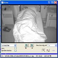 Analiza stadiów snu z wykresem jego architektury (hipnogram) oraz ocena wiarygodności tej analizy. Wykrywanie okresów snu REM oraz ocena intensywności snu REM.