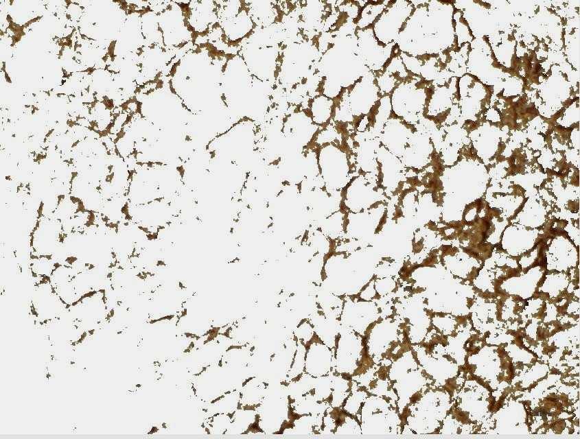B obraz barwny H, uzyskany przed rzutem immunocytochemicznej reakcji na płaszczyznę C projekcja obrazu reakcji