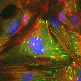 300 400 500 600 700 α-tubulin Total length of cell movement [μm] 200 100 0 200 100 0 100 200 300 400