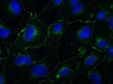 β-catenin α-tubulin tubulin PC-3 Cx43 α-tubulin