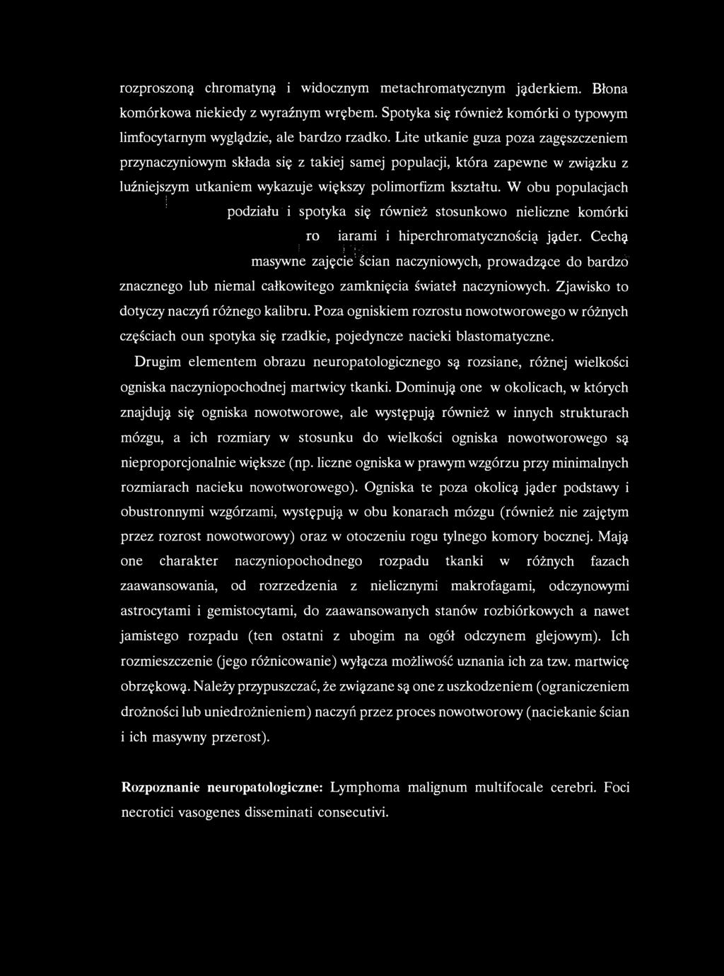 rozproszoną chromatyną i widocznym metachromatycznym jąderkiem. Błona komórkowa niekiedy z wyraźnym wrębem. Spotyka się również komórki o typowym limfocytarnym wyglądzie, ale bardzo rzadko.