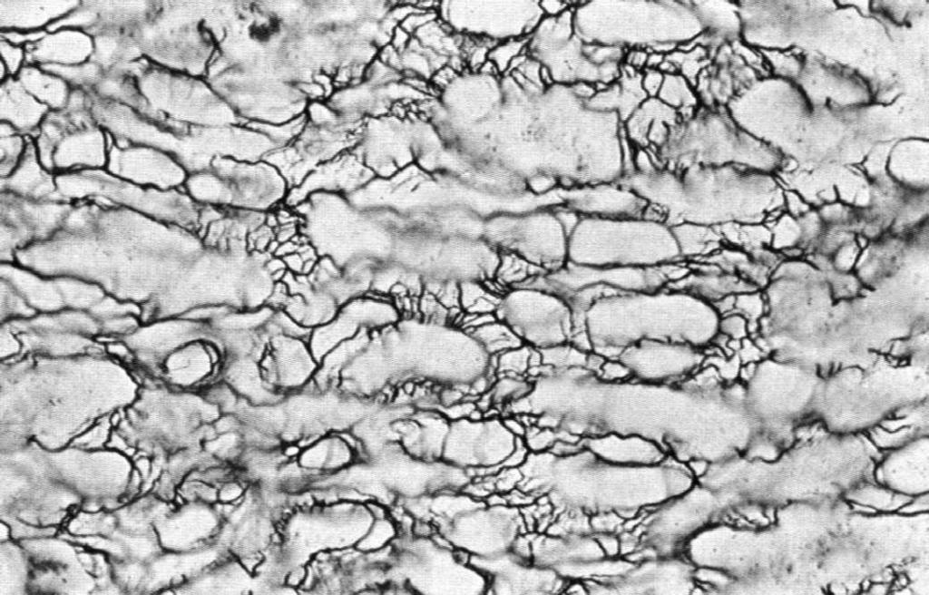 kolagenu I grube (kilka µm), utworzone przez prąŝkowane fibryle