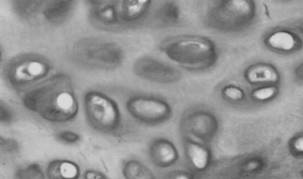 substancji międzykomórkowej w chrząstce (chondroblasty