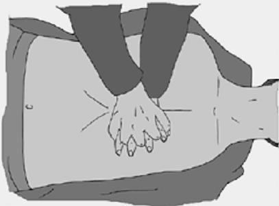 251 uklęknij obok rannego; ułóż nadgarstek jednej ręki na środku klatki piersiowej rannego; Rys.7.8.Ułożenie nadgarstka jednej ręki na środku klatki piersiowej.