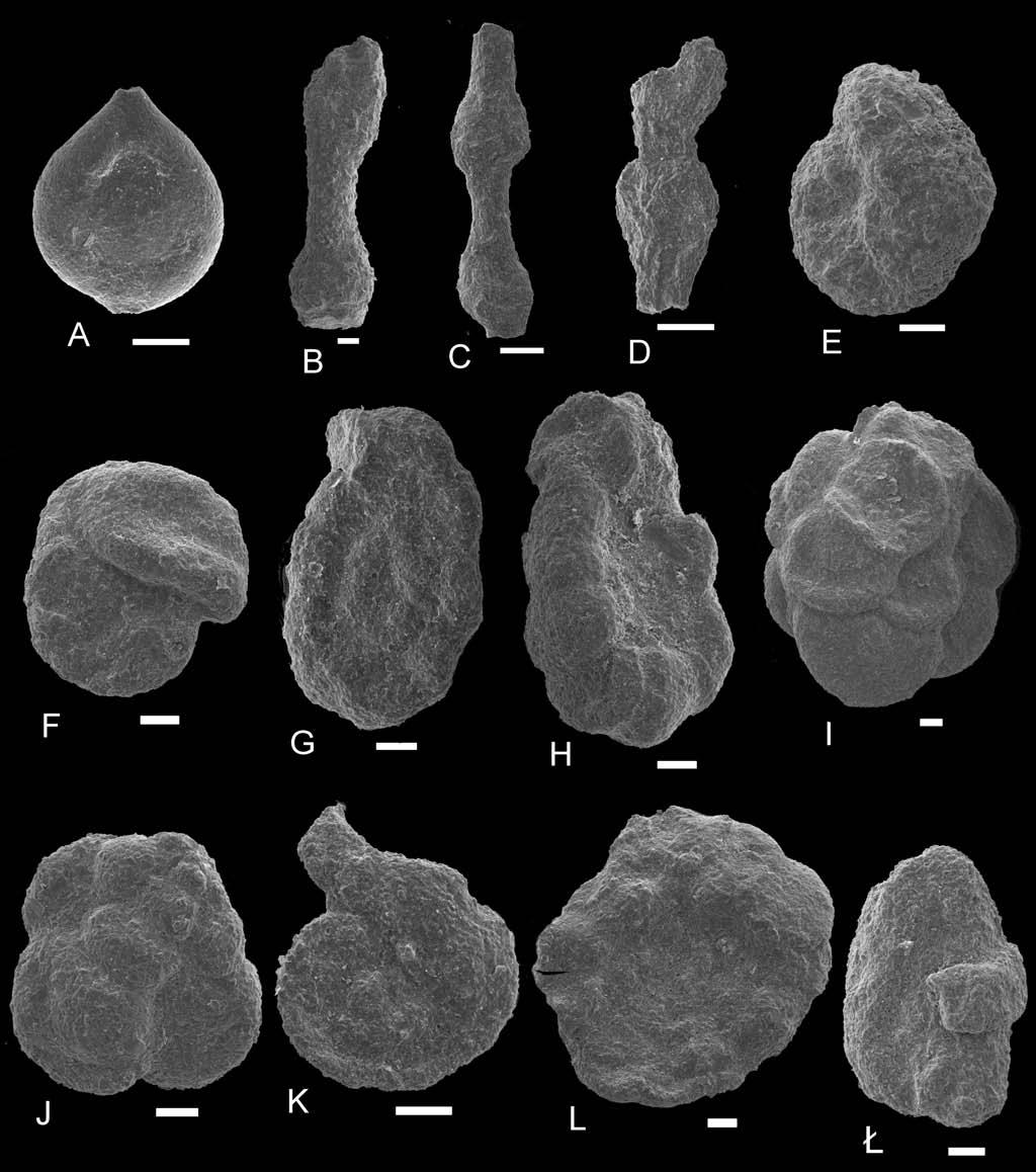 282 M. C ESZ KOWSK ET AL. Fig. 10. SEM-pho tos of foraminifera from the Mutne lo cal ity. A Caudammina ovula (Grzybowski) (s. 100), B, C Caudammina excelsa (Dyl¹ anka) (s.