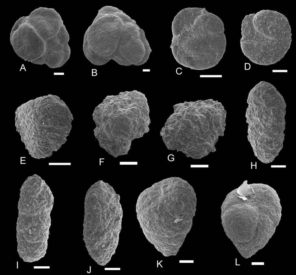 TYPE LO CAL TY OF THE MUTNE SAND STONE MEMBER 283 Fig. 11. SEM-pho tos of foraminifera from the Mutne lo cal ity. A Paratrochamminoides irregularis (White) (s.