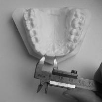 the comparison of the data received (Fig. 3, 4). Rycina 3. Porównanie wielkości i kształtu suwmiarek Figure 3. Size and shape comparison of the caliper Rycina 4.