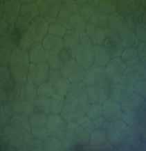magnification).