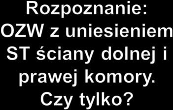 ściany dolnej Czego