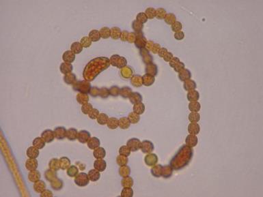 charakterystyka toksyn cyjanobakterii występujących w polskich wodach przybrzeżnych i śródlądowych z zastosowaniem metod chromatograficznych i spektrometrii mas; ocena aktywności