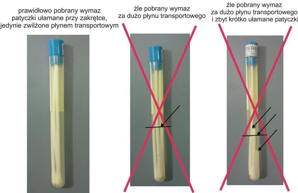 a następnie powolnym ruchem rotacyjnym wyjąć. Koniec patyczka wymazowego (tuż przy zakrętce) odłamać. Patyczek wymazowy umieścić w probówce, z którą został on dostarczony. Probówkę zakręcić.