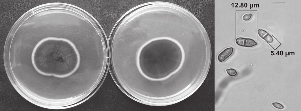 350 RAFAŁ OGÓREK, AGNIESZKA LEJMAN Rys. 6. Hodowla Cladosporium herbarum w szalce Petriego z podłożem PDA i wygląd zarodników pod mikroskopem przy powiększeniu 40x (fot. R. Ogórek) z rodzaju Penicillium.