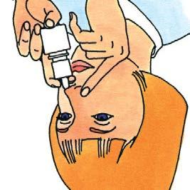 Wstrząsnąć delikatnie butelkę i zdjąć nasadkę ochronną. (Rycina 1) 2. Delikatnie wydmuchać nos. 3.