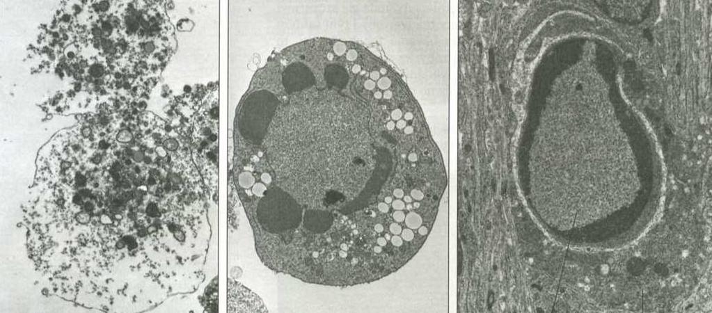 Apoptoza programowana śmierć komórki jest prowadzona przez rodzinę proteaz (enzymów rozcinających inne białka) - KASPAZ KASPAZY są syntezowane jako nieaktywne prekursory PROKASPAZY, które same są