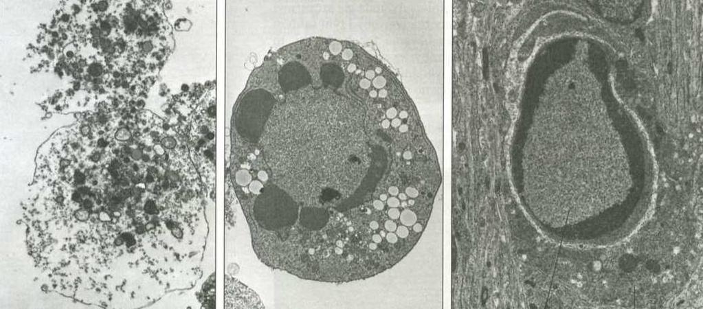 Apoptoza programowana śmierć komórki jest prowadzona przez rodzinę proteaz (enzymów rozcinających inne białka) - KASPAZ KASPAZY są syntezowane jako nieaktywne prekursory PROKASPAZY, które same są