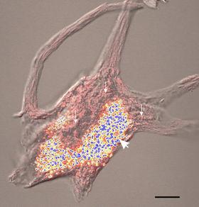 Ciało komórki Obraz komórki nerwowej człowieka z odcinka lędźwiowego rdzenia kręgowego w mikroskopie konfokalnym, barwienie błękitem metylenowym.