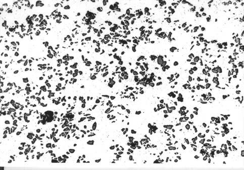 a) 258 b) Rys. 1. Struktura kompozytu AG10-SiC: a) pow. 25x, b) pow. 400x Fig. 1. Structure of composite AG10-SiC: a) magn. 25x, b) magn.