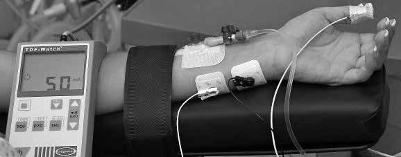 rywanie bloku przewodnictwa nerwowo-mięśniowego neostygminą, a także ułatwia określenie optymalnego momentu do przeprowadzenia intubacji i ekstubacji tchawicy.